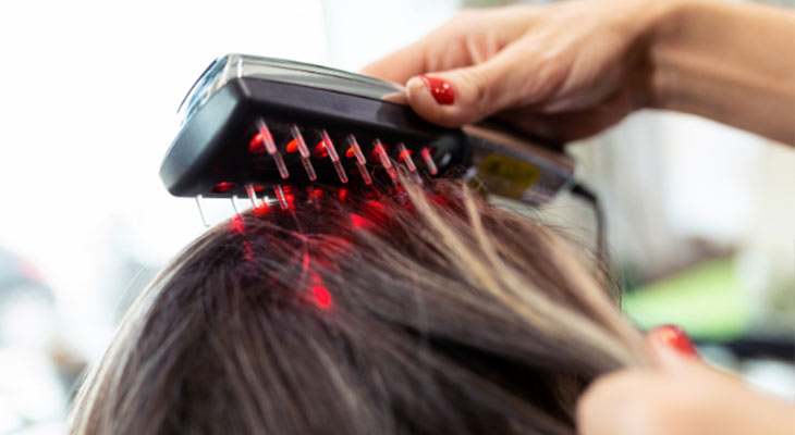 Laser Hair Loss Treatments
