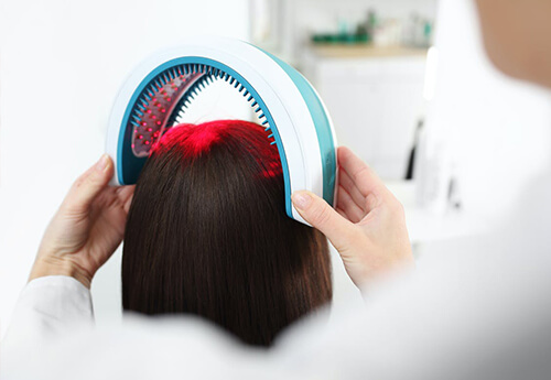 Laser Hair Regrowth Therapy