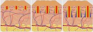 Trifractional